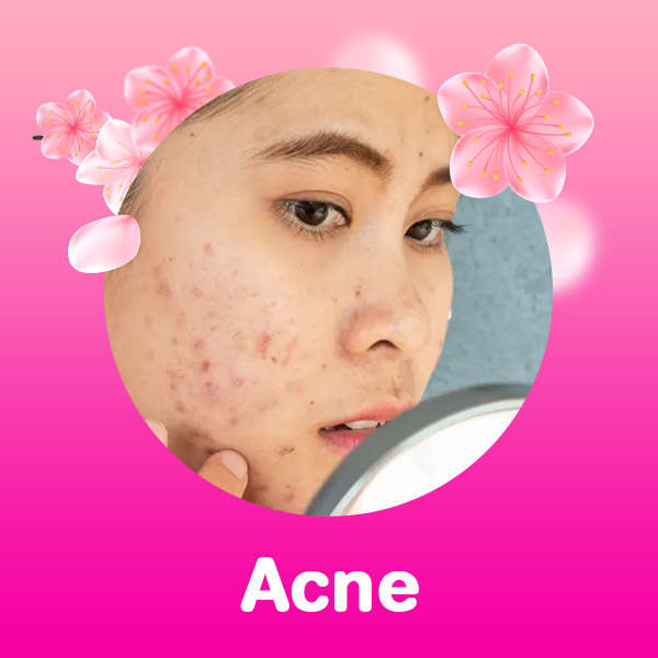 Acni in fashionskincarebd